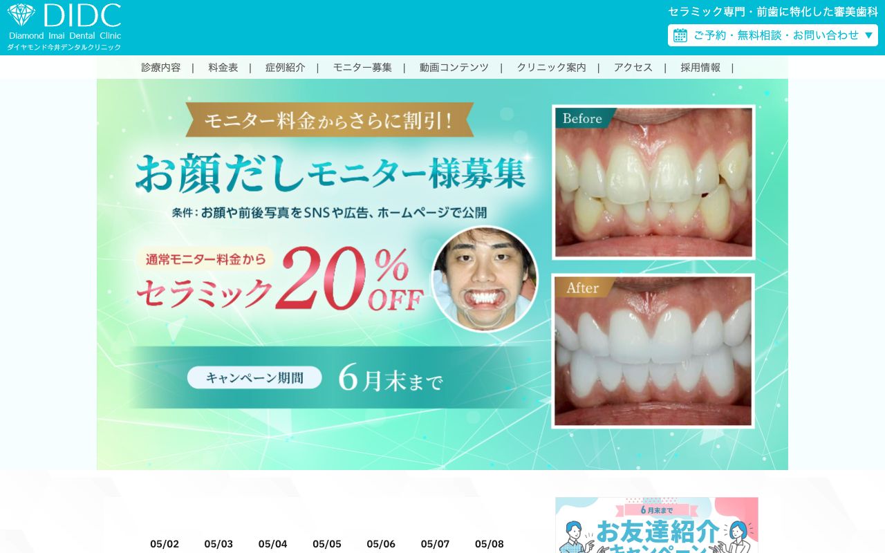 ダイヤモンド今井デンタルクリニックのホームページ