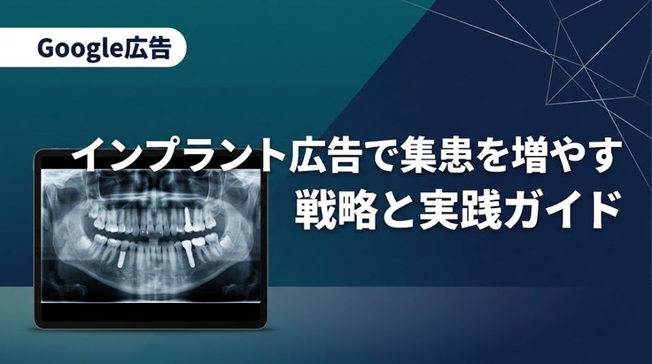 インプラント広告で集患を増やす戦略と実践ガイド