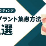 インプラント集患方法12選｜自費診療の患者を増やす実践戦略