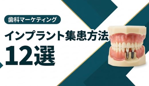 インプラント集患方法12選｜自費診療の患者を増やす実践戦略
